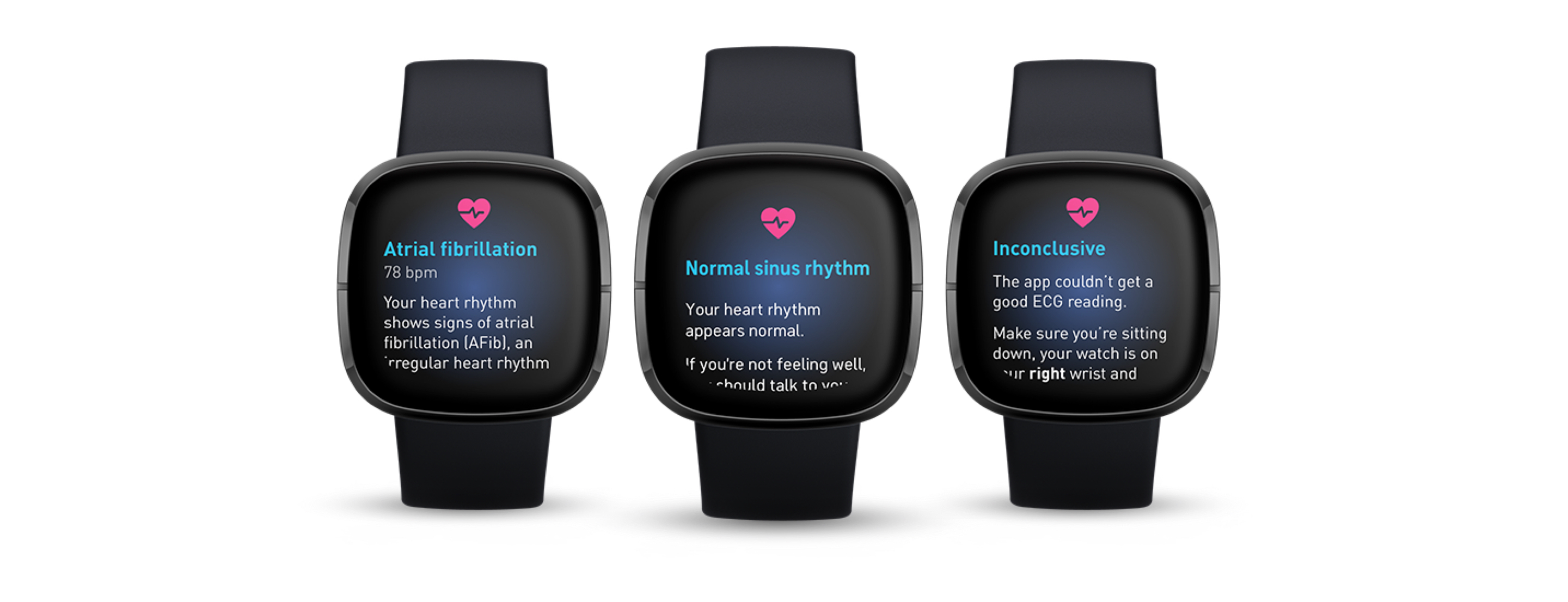 Fitbit ECG app | Heart Rhythm Assessment